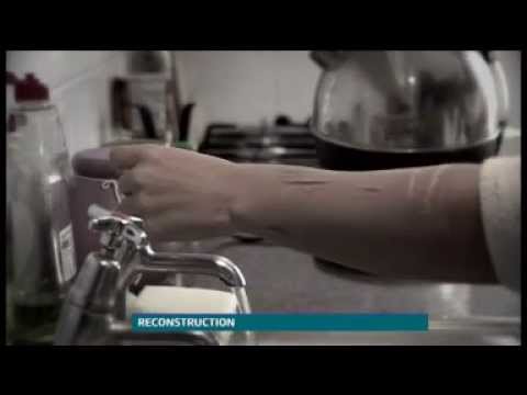 Fixers Self Harm story on ITV News Central, June 2013