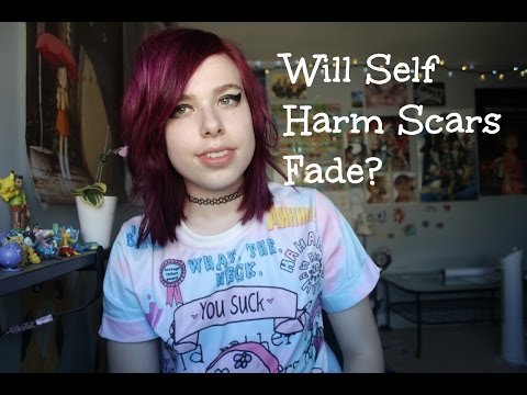 When Will Self Harm Scars Fade? (´`;) ? When Will Self Harm Scars Fade? (´`;) ?