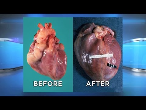 This is Your Heart on Cocaine This is Your Heart on Cocaine