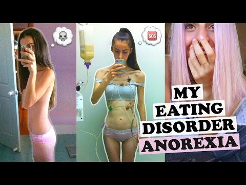 MY EATING DISORDER STORY | Anorexia In Pictures MY EATING DISORDER STORY | Anorexia In Pictures